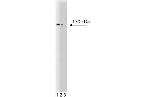 Western blot analysis of Apaf-1 on a human endothelial cell lysate. (APAF1 anticorps  (AA 252-445))