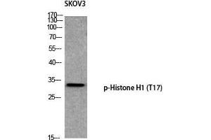 Western Blot (WB) analysis of SKOV3 using p-Histone H1 (T17) antibody. (Histone H1 anticorps  (pThr17))