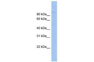 ABCB6 antibody used at 1 ug/ml to detect target protein. (ABCB6 anticorps)