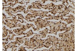 ABIN6276314 at 1/100 staining Human lung tissue by IHC-P. (FGF2 anticorps  (C-Term))