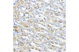 Immunohistochemistry of paraffin-embedded rat stomach using GPX2 antibody (ABIN7267435) at dilution of 1:100 (40x lens). (Glutathione Peroxidase 2 anticorps  (AA 100-180))