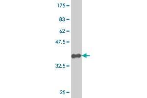 Western Blot detection against Immunogen (36. (Nucleostemin anticorps  (AA 328-427))