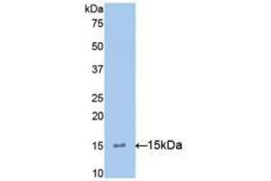 Western blot analysis of recombinant Mouse IL15. (IL-15 anticorps  (AA 49-162))
