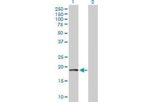 Western Blot analysis of TIMM22 expression in transfected 293T cell line by TIMM22 MaxPab polyclonal antibody. (TIMM22 anticorps  (AA 1-194))