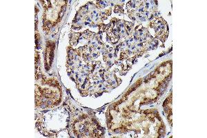 Immunohistochemistry of paraffin-embedded human kidney using Human IgM Rabbit mAb (ABIN7267845) at dilution of 1:100 (40x lens). (IGHM anticorps)