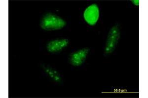 Immunofluorescence of monoclonal antibody to GCM1 on HeLa cell. (GCM1 anticorps  (AA 108-166))