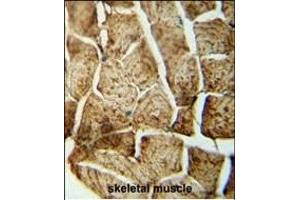 SD4 antibody (N-term) (ABIN652084 and ABIN2840541) immunohistochemistry analysis in formalin fixed and paraffin embedded human skeletal muscle followed by peroxidase conjugation of the secondary antibody and DAB staining.