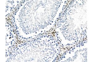 Phospho-YAP (Ser941) Antibody at 1/100 staining Rat testis tissue by IHC-P. (YAP1 anticorps  (pSer941))