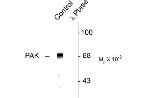 Western blots of rat hippocampal lysate showing specific immunolabeling of the ~68k to ~70k PAK protein (Control). (PAK1-3 (pThr402) anticorps)