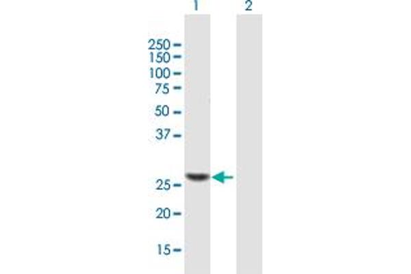 TRMU anticorps  (AA 1-222)