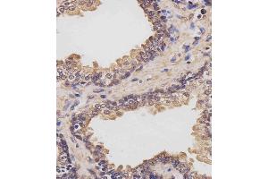 (ABIN6243855 and ABIN6577442) staining RK7 in human prostate tissue sections by Immunohistochemistry (IHC-P - raformaldehyde-fixed, raffin-embedded sections).