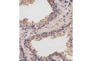 (ABIN6243855 and ABIN6577442) staining RK7 in human prostate tissue sections by Immunohistochemistry (IHC-P - raformaldehyde-fixed, raffin-embedded sections). (PARK7/DJ1 anticorps  (C-Term))