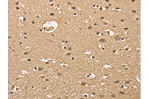 The image on the left is immunohistochemistry of paraffin-embedded Human brain tissue using ABIN7128351(ALDH8A1 Antibody) at dilution 1/30, on the right is treated with fusion protein. (ALDH8A1 anticorps)