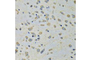 Immunohistochemistry of paraffin-embedded rat brain using DARS antibody (ABIN5973949) at dilution of 1/100 (40x lens). (DARS anticorps)