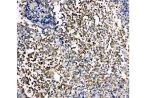 IHC-P: KIM-1 antibody testing of human tonsil tissue (HAVCR1 anticorps  (C-Term))