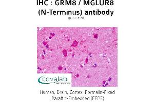 Image no. 1 for anti-Glutamate Receptor, Metabotropic 8 (GRM8) (Extracellular Domain), (N-Term) antibody (ABIN1735284)