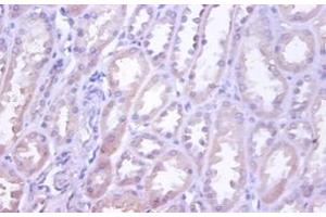 Immunohistochemistry of paraffin-embedded human kidney using TNFRSF10D / TRAIL-R4 / DCR2 antibody at dilution of 1:100.