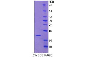 SDS-PAGE analysis of Human NARF Protein. (NARF Protéine)