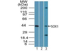 Image no. 1 for anti-SRY (Sex Determining Region Y)-Box 1 (SOX1) (AA 350-400) antibody (ABIN960349) (SOX1 anticorps  (AA 350-400))