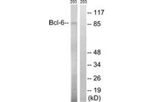 Western blot analysis of extracts from 293 cells, using Bcl-6 (Ab-333) Antibody. (BCL6 anticorps  (AA 299-348))