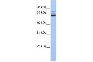 WB Suggested Anti-GEFT Antibody Titration: 0. (ARHGEF25/GEFT anticorps  (C-Term))