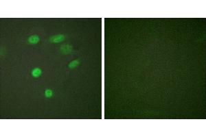 P-peptide - +Immunofluorescence analysis of HeLa cells, using CDC16/APC6 (Phospho-Ser560) antibody. (CDC16 anticorps  (pSer560))