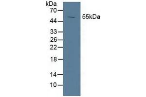 Detection of LXRa in Porcine Spleen Tissue using Polyclonal Antibody to Liver X Receptor Alpha (LXRa)