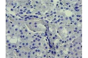 ABIN870680 Negative Control showing staining of paraffin embedded Rat Kidney, with no primary antibody.