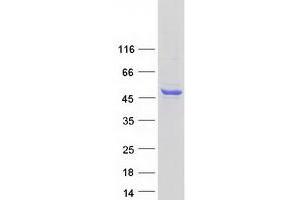 Validation with Western Blot