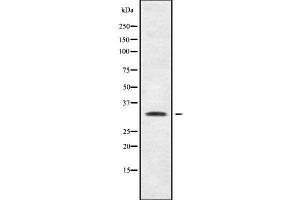 Western blot analysis SHOX using MCF7 whole cell lysates (SHOX anticorps  (N-Term))