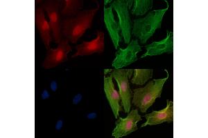 ABIN6257961 and ABIN6274900 staining  cells by IF/ICC. (BOK anticorps  (N-Term))