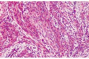 Human Muscle: Formalin-Fixed, Paraffin-Embedded (FFPE)