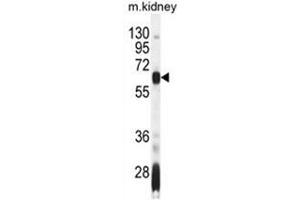 AIRE Antibody (Center) western blot analysis in mouse kidney tissue lysates (35 µg/lane).