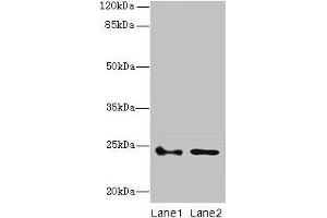 Western blot All lanes: RHOF antibody at 3 μg/mL Lane 1: Colo320 whole cell lysate Lane 2: RAW264.