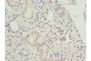 Immunohistochemistry of paraffin-embedded human pancreatic tissue using ABIN7145599 at dilution of 1:100 (Biliverdin Reductase anticorps  (AA 1-296))