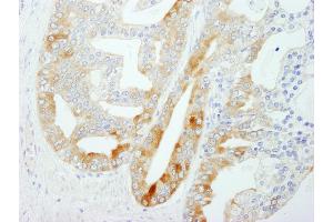 Immunohistochemistry (IHC) image for anti-Fatty Acid Synthase (FASN) (AA 1175-1225) antibody (ABIN7453706)