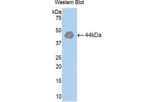 WB of Protein Standard: different control antibodies against Highly purified E. (Hexokinase 1 Kit ELISA)