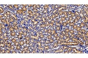 Detection of SQSTM1 in Mouse Kidney Tissue using Polyclonal Antibody to Sequestosome 1 (SQSTM1)