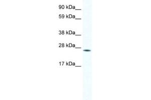 Western Blotting (WB) image for anti-Homeobox B7 (HOXB7) antibody (ABIN2461469) (HOXB7 anticorps)