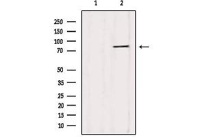 Western blot analysis of extracts from HepG2, using YME1L1 Antibody. (YME1L1 anticorps  (C-Term))