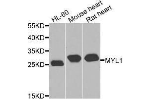 Western blot analysis of extracts of various cell lines, using MYL1 antibody (ABIN5974855) at 1/1000 dilution. (MYL1 anticorps)