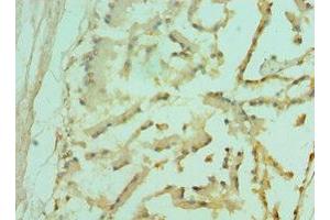 Immunohistochemistry of paraffin-embedded human prostate tissue using ABIN7153096 at dilution of 1:100