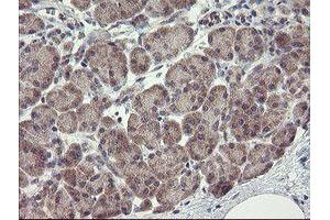 Image no. 3 for anti-rho GTPase Activating Protein 2 (ARHGAP2) antibody (ABIN1499627) (CHN1 anticorps)