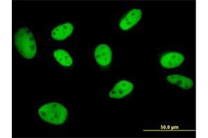 Immunofluorescence of monoclonal antibody to GTF2I on HeLa cell. (GTF2I anticorps  (AA 36-274))