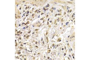 Immunohistochemistry (IHC) image for anti-Jun Proto-Oncogene (JUN) (AA 1-70) antibody (ABIN1513116)