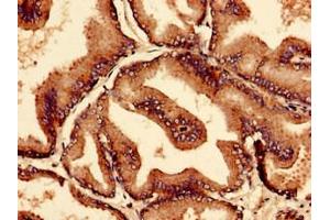 anti-CTP Synthase II (CTPS2) (AA 62-315) antibody