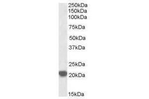 Image no. 1 for anti-Ras-Related C3 Botulinum Toxin Substrate 2 (Rho Family, Small GTP Binding Protein Rac2) (RAC2) (C-Term) antibody (ABIN374166)