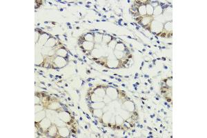 Immunohistochemistry of paraffin-embedded human colon using LDB1 antibody (ABIN7268255) at dilution of 1:200 (40x lens).