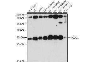 Western blot analysis of extracts of various cell lines, using T antibody (ABIN7266436) at 1:1000 dilution. (TACO1 anticorps  (AA 1-297))