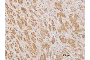 Image no. 1 for anti-N-Methylpurine-DNA Glycosylase (MPG) (AA 1-90) antibody (ABIN598820) (MPG anticorps  (AA 1-90))